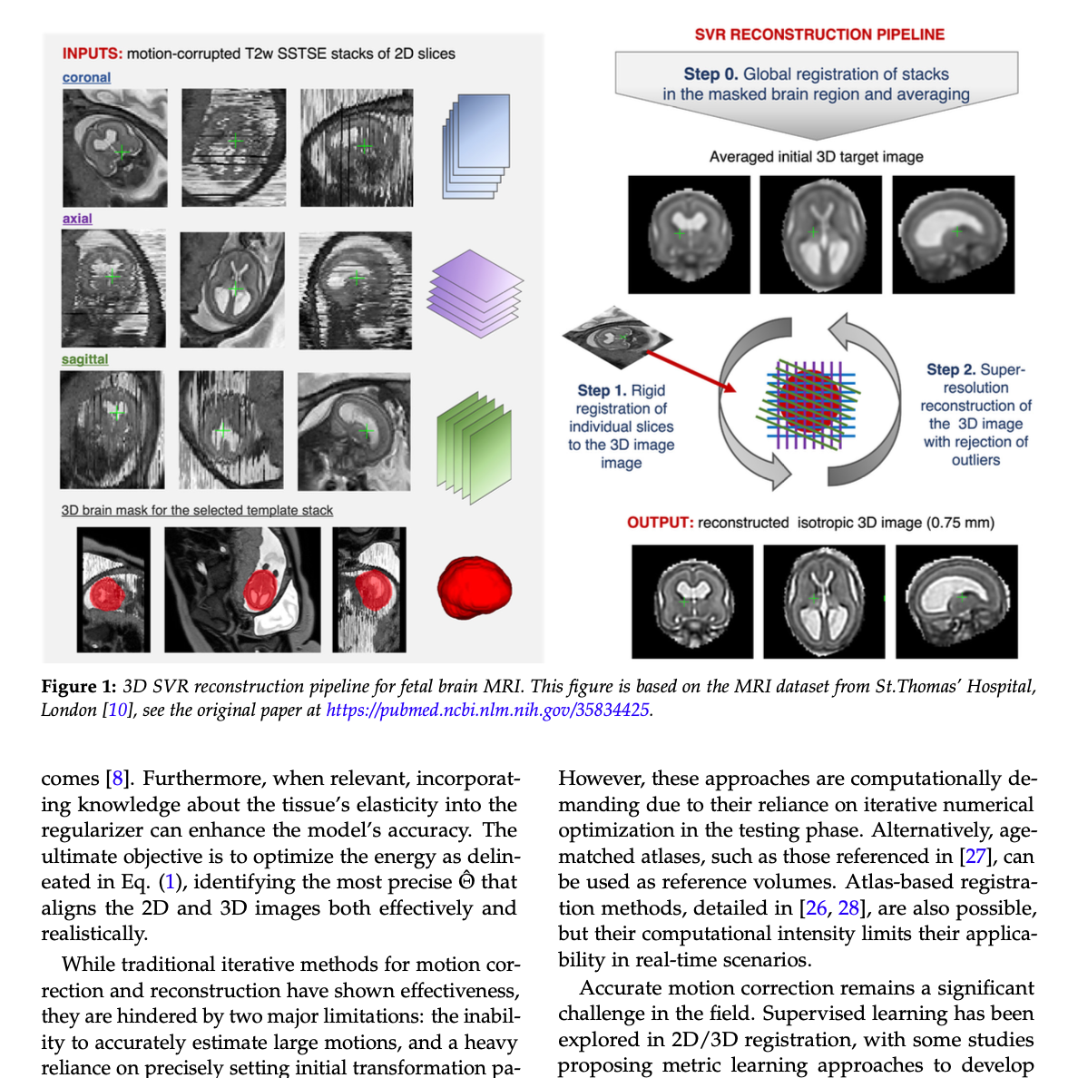 Fetus Brain MRI Motion Correction Thumbnail
